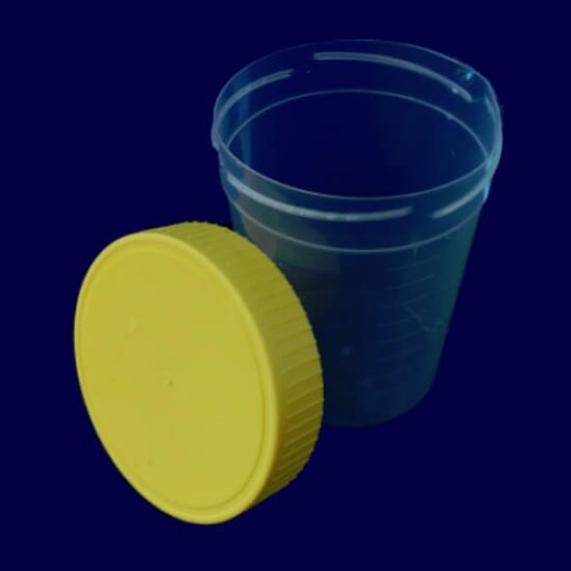 Pojemnik na mocz, niesterylny, 100ml