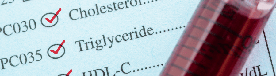 Wysoki poziom trójglicerydów - przyczyny, objawy i leczenie
